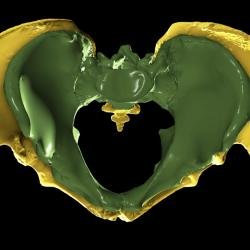 Pelvis comparadas